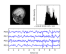 mri_with_eeg
